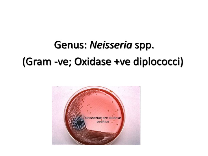 genus neisseria spp gram ve oxidase ve diplococci