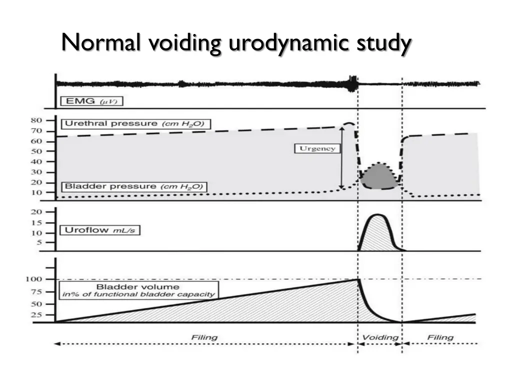 normal voiding urodynamic study