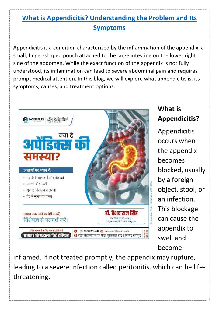 what is appendicitis understanding the problem