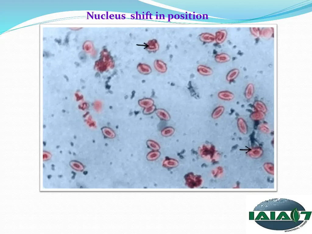 nucleus shift in position