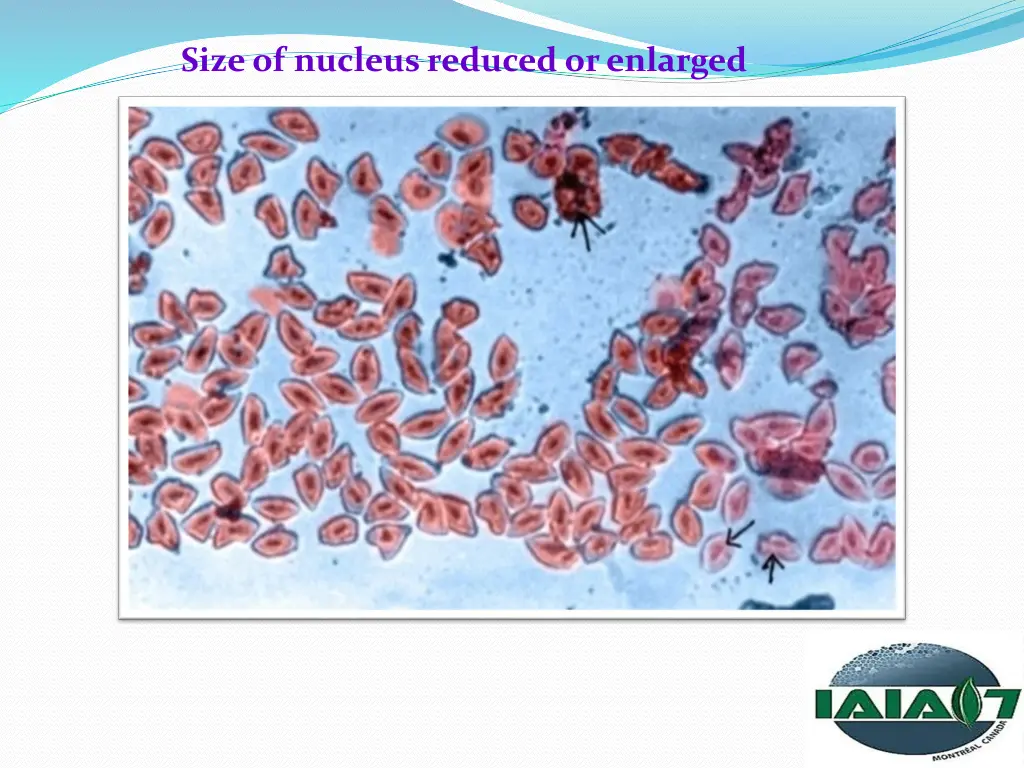 size of nucleus reduced or enlarged