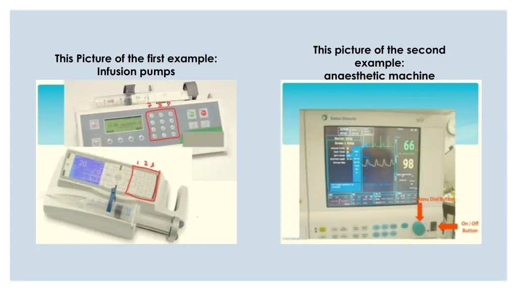 this picture of the second example anaesthetic