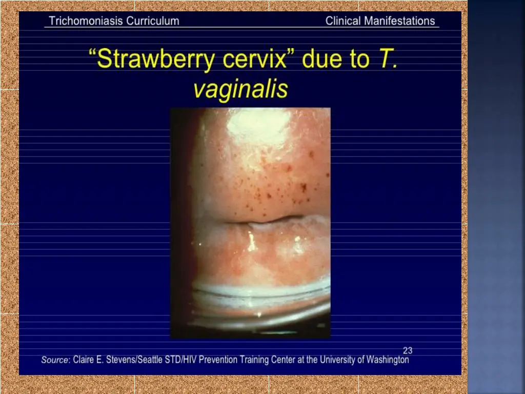 slide13