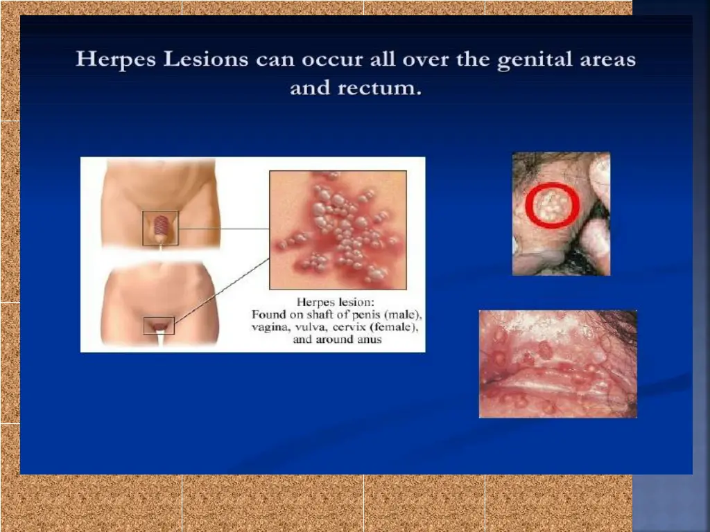 slide44