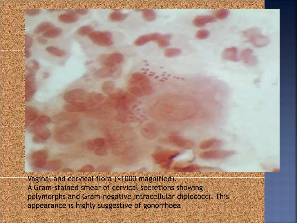 vaginal and cervical flora 1000 magnified a gram