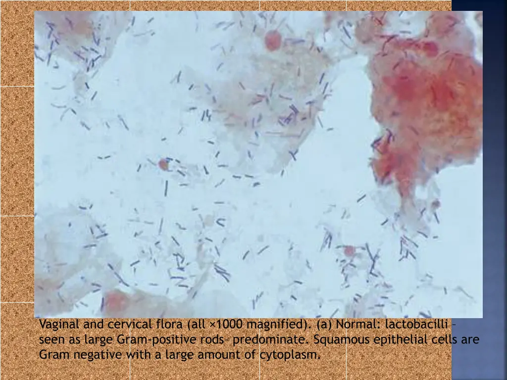 vaginal and cervical flora all 1000 magnified