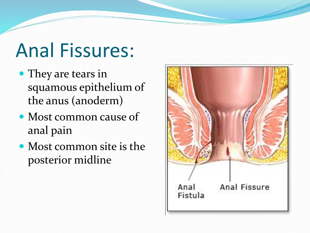 anal fissures