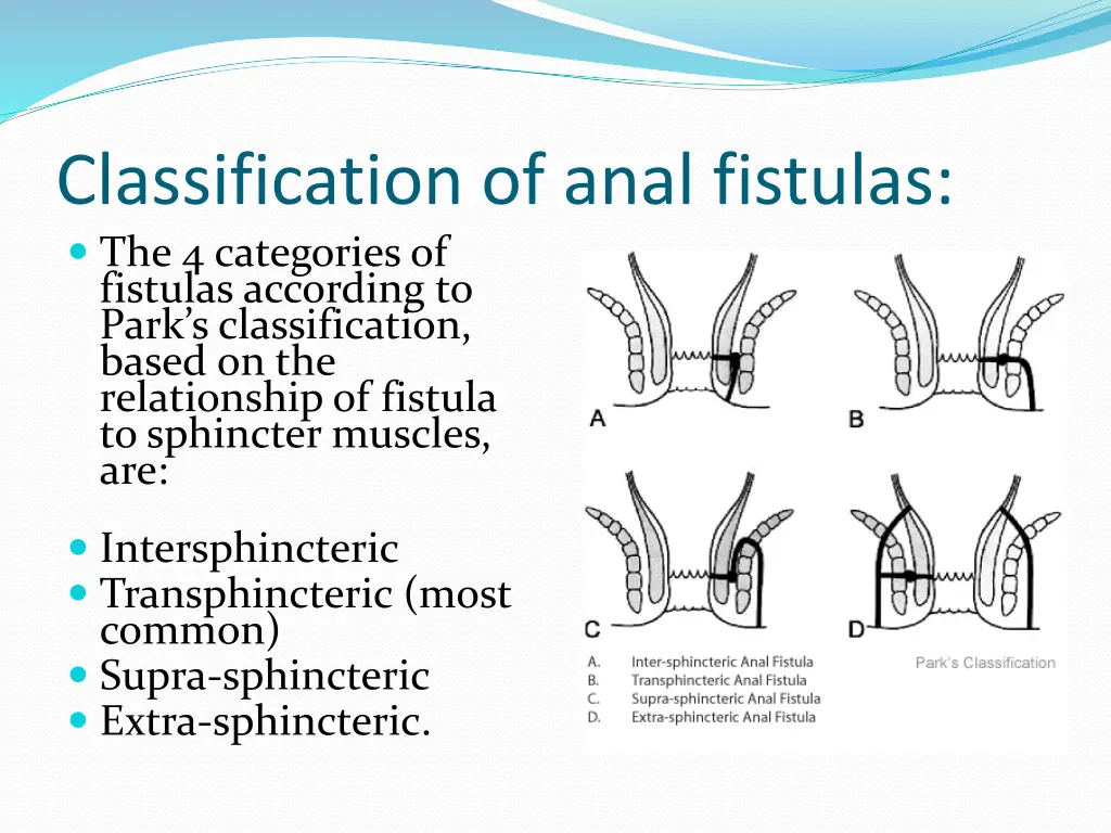 classification of anal fistulas the 4 categories