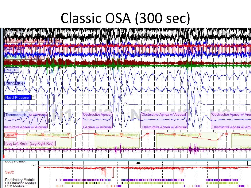 classic osa 300 sec