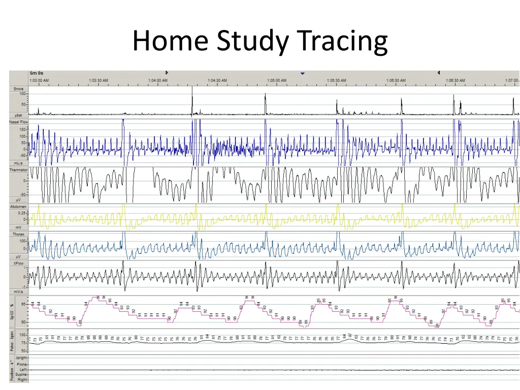 home study tracing