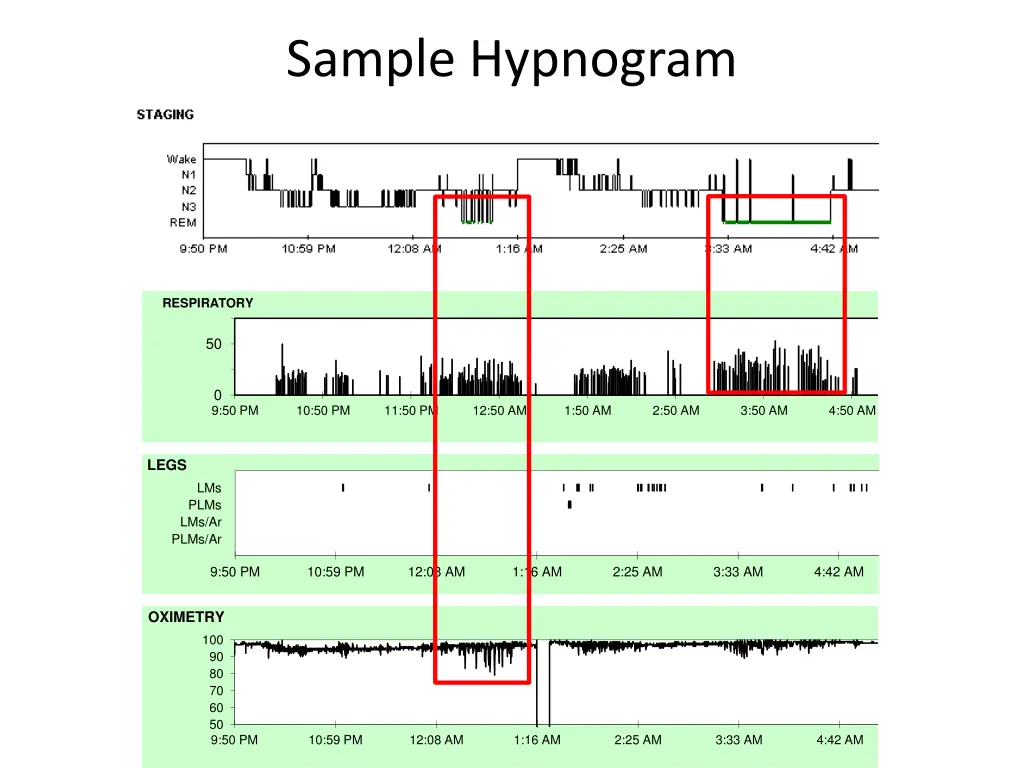 sample hypnogram