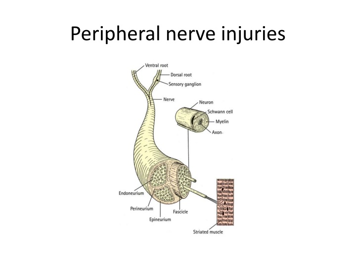 peripheral nerve injuries