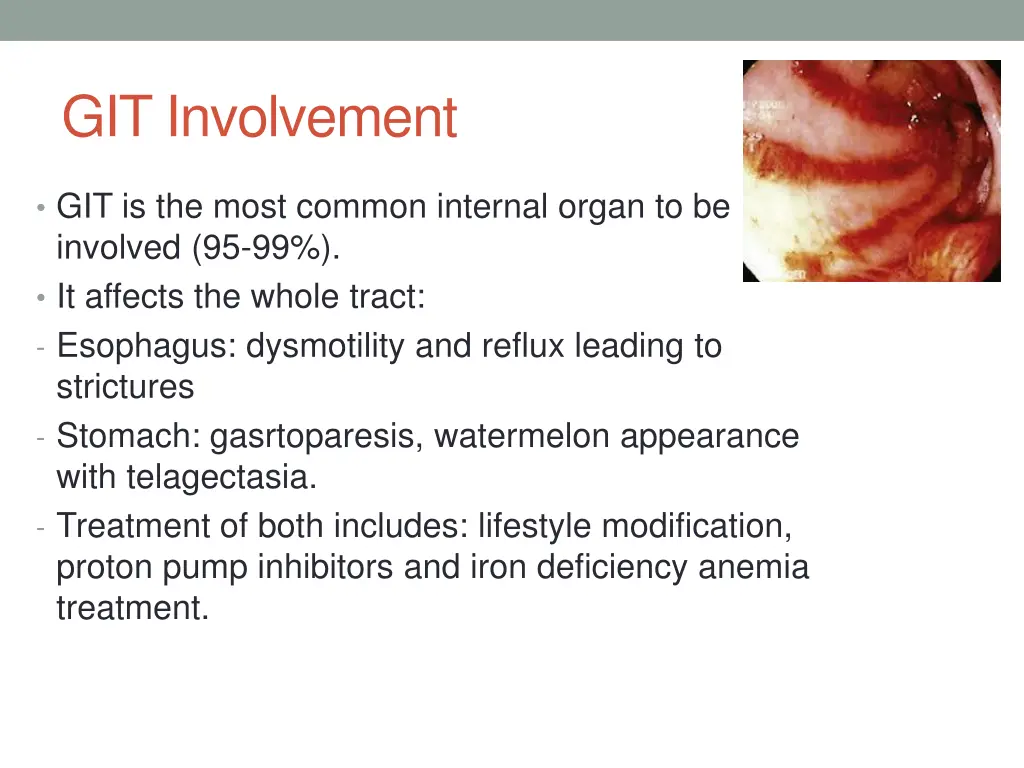 git involvement