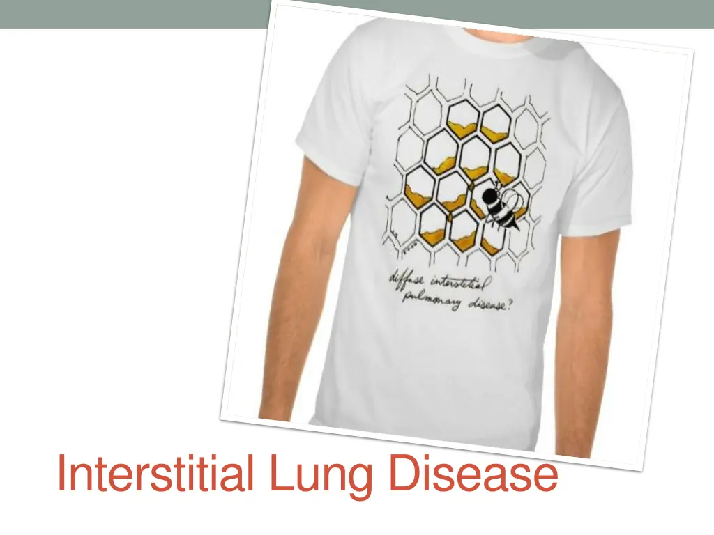 interstitial lung disease