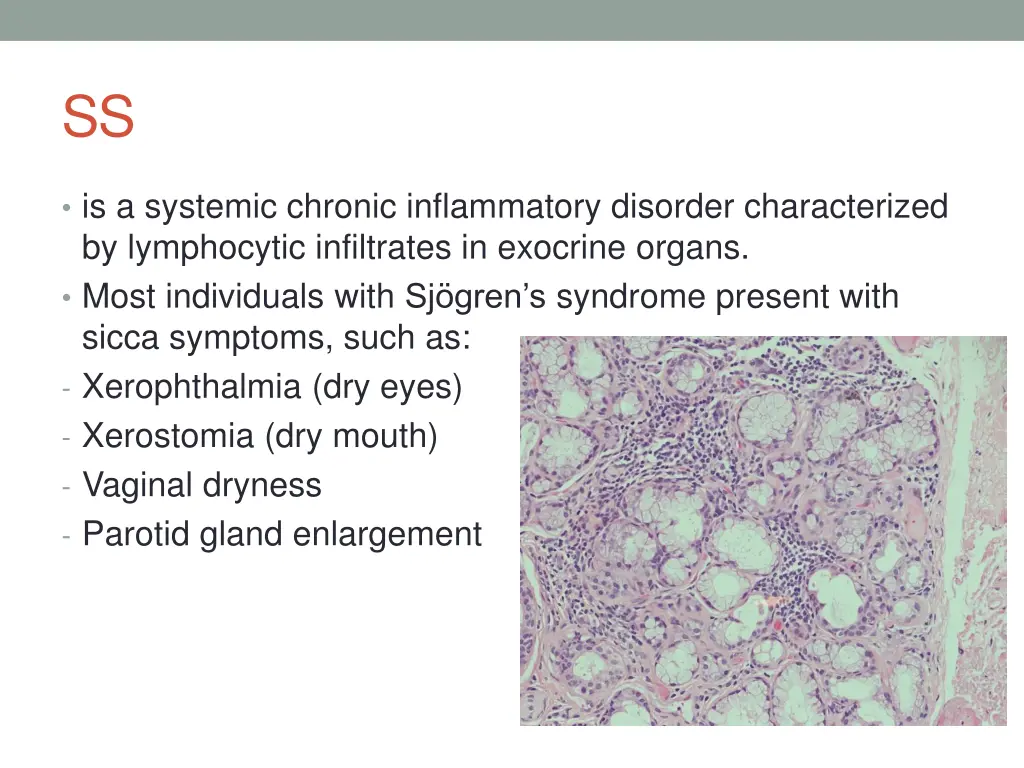 slide38