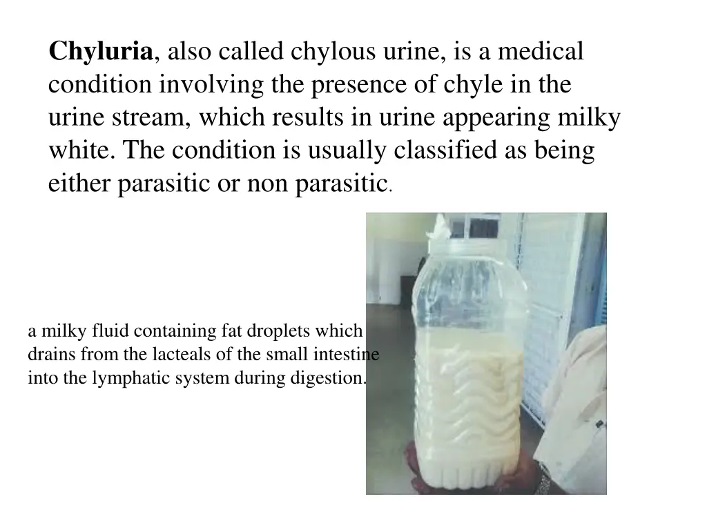 chyluria also called chylous urine is a medical