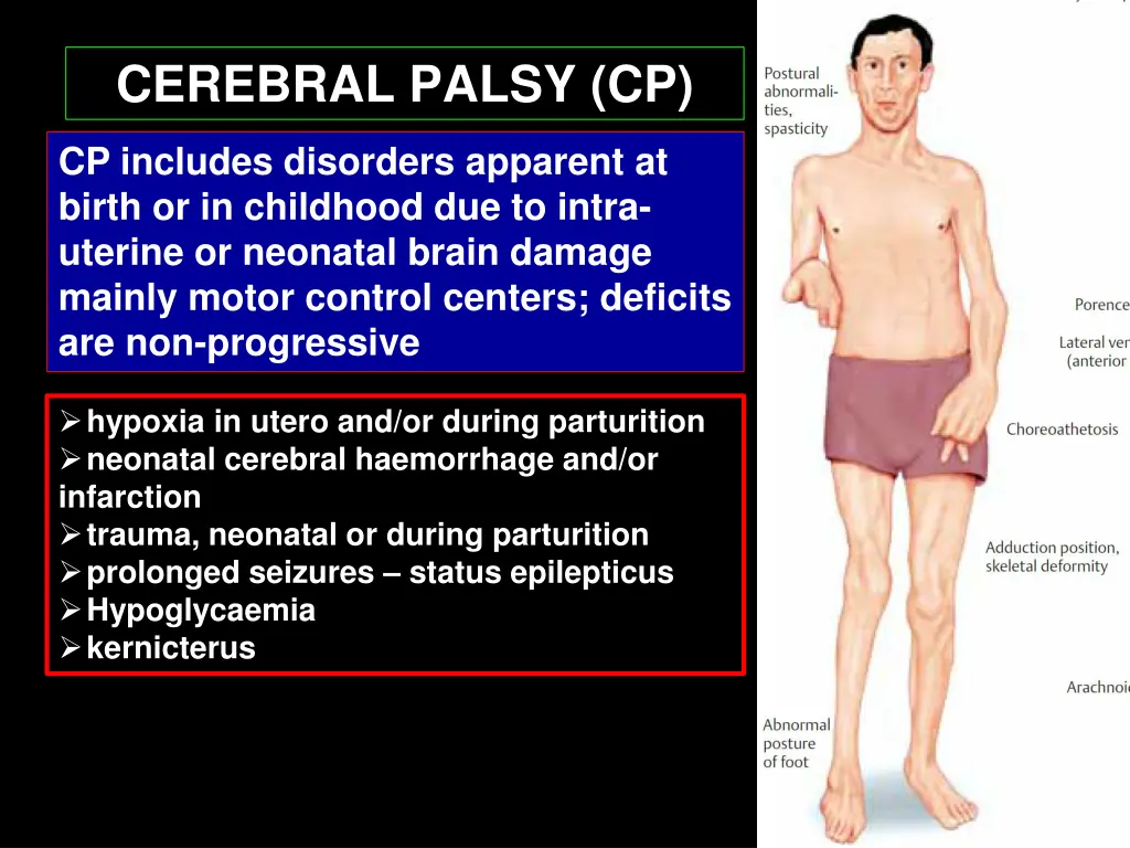 cerebral palsy cp