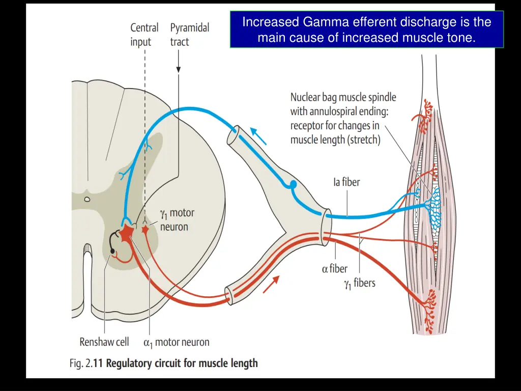 increased gamma efferent discharge is the main