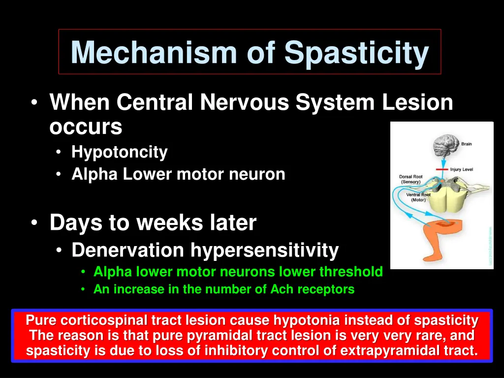 mechanism of spasticity