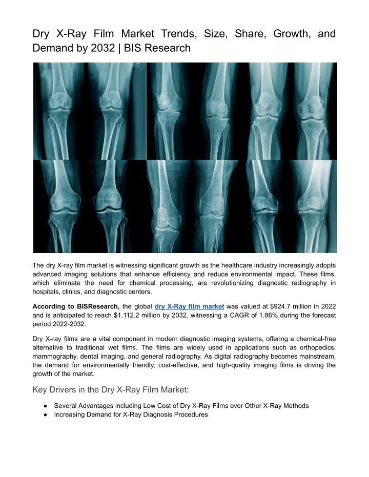 dry x ray film market trends size share growth