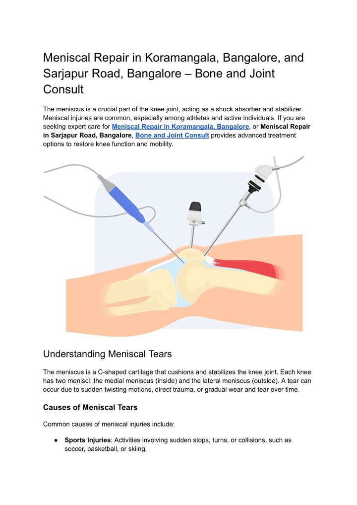 meniscal repair in koramangala bangalore