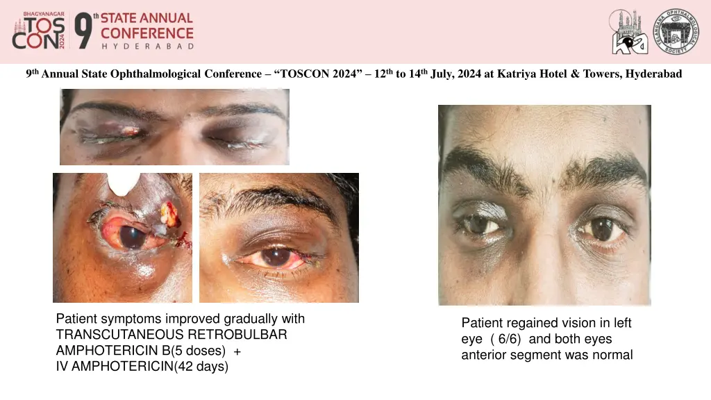 9 th annual state ophthalmological conference 2