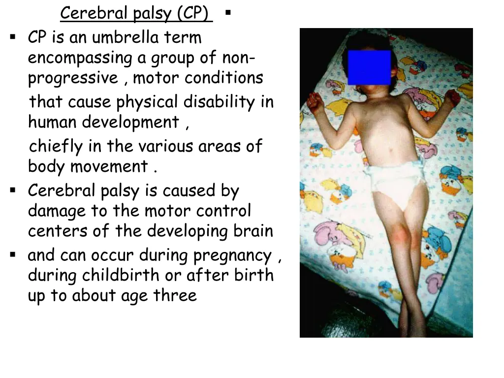 cerebral palsy cp cp is an umbrella term