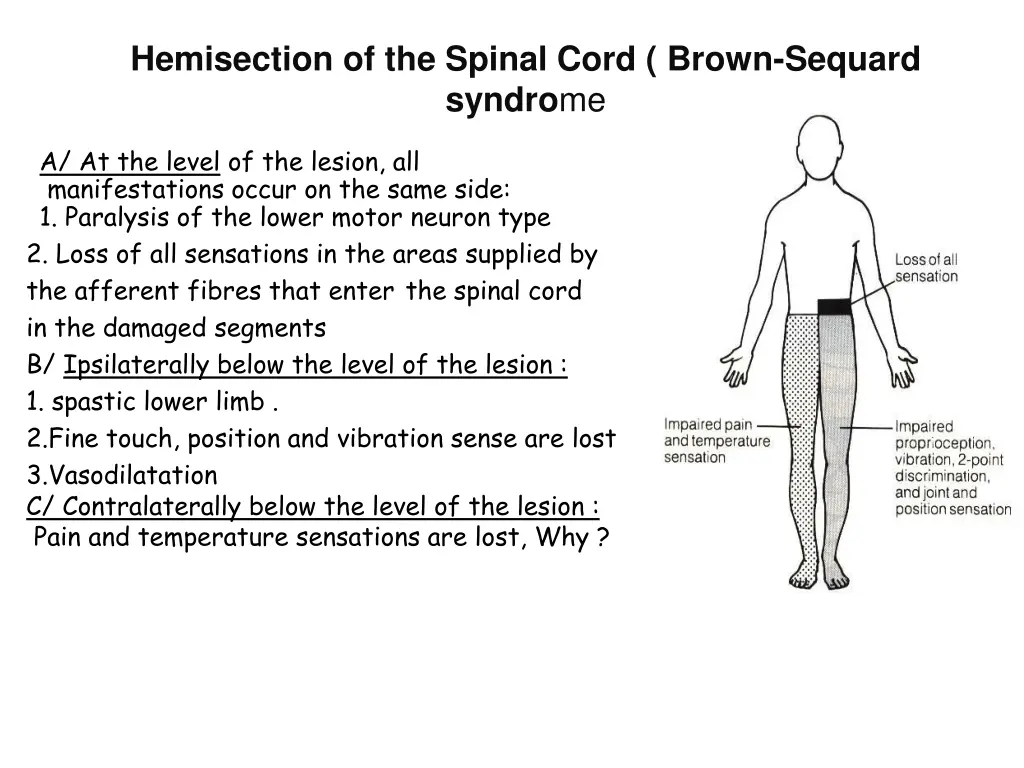 hemisection of the spinal cord brown sequard