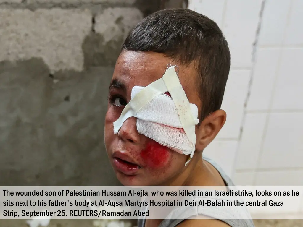 the wounded son of palestinian hussam al ejla