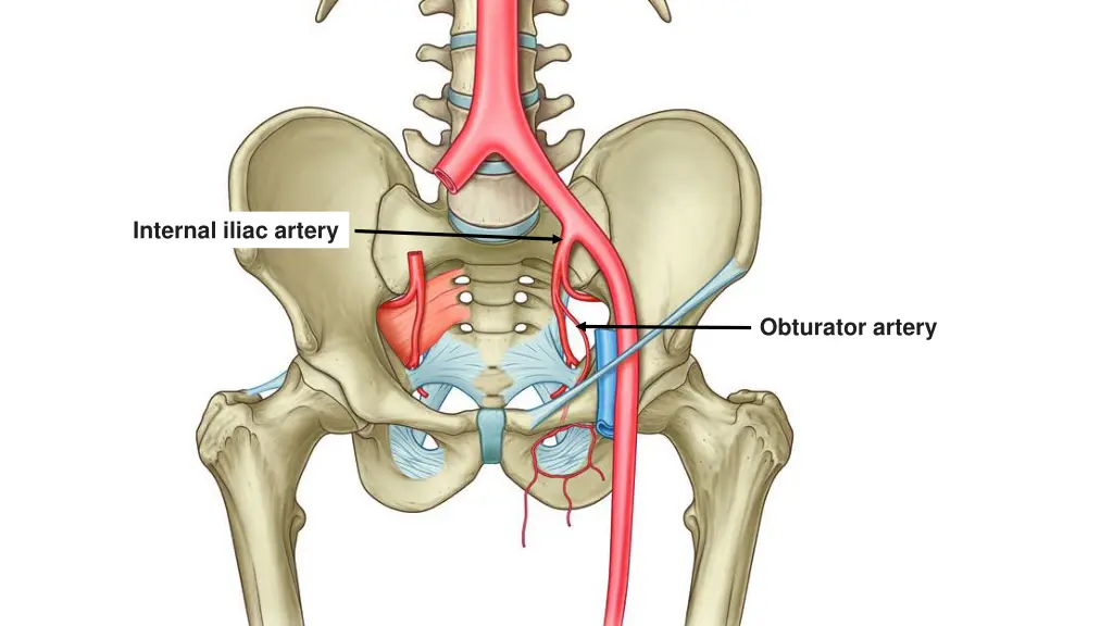 internal iliac artery