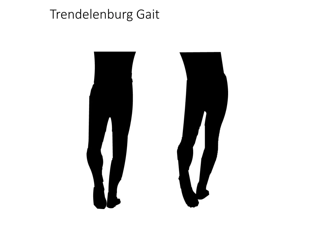 trendelenburg gait