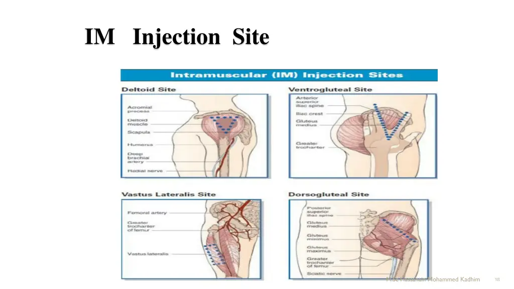 im injection site