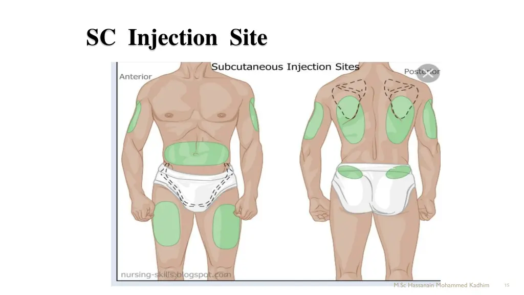 sc injection site