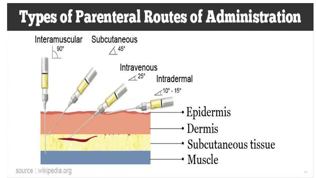 slide20