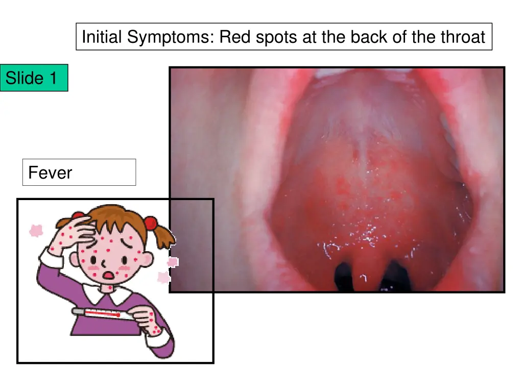 initial symptoms red spots at the back