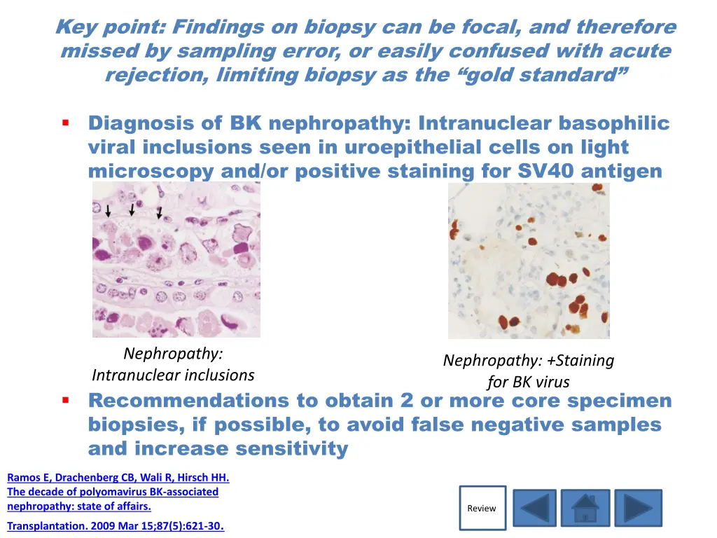 key point findings on biopsy can be focal