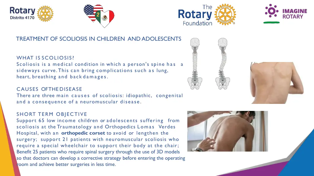 treatment of scoliosis in children and adolescents