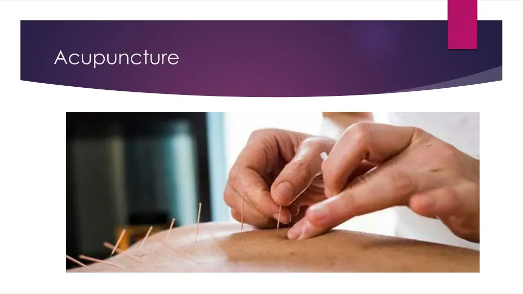 acupuncture