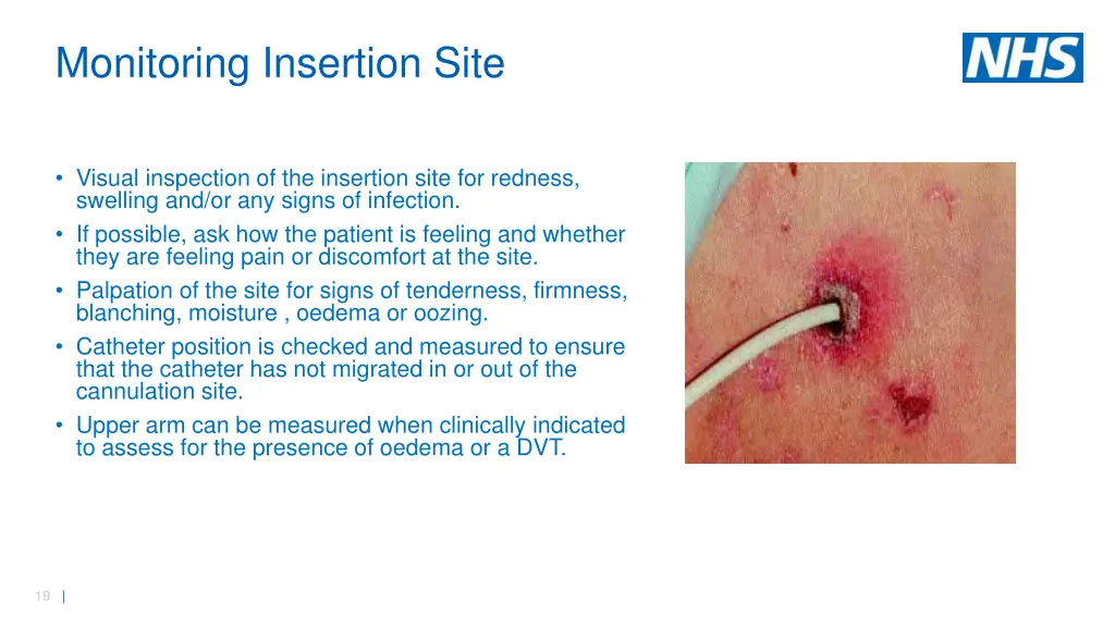 monitoring insertion site