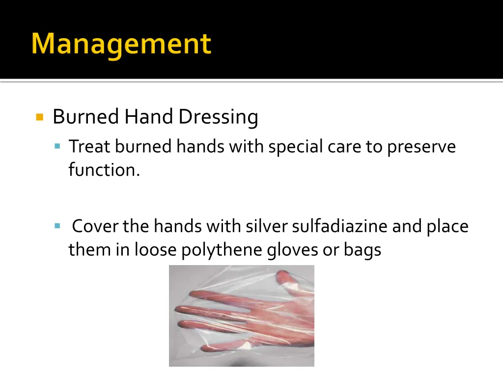 burned hand dressing treat burned hands with