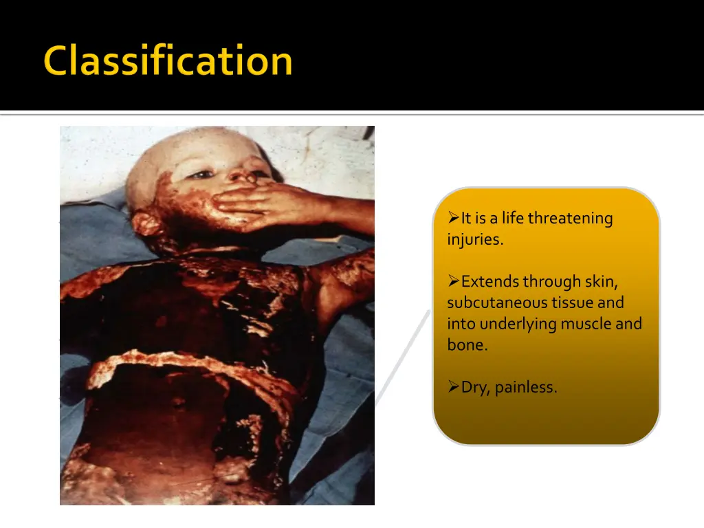 slide18