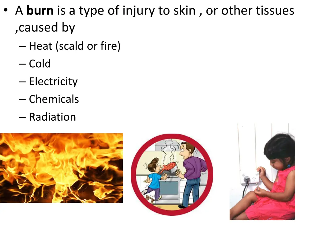 a burn is a type of injury to skin or other