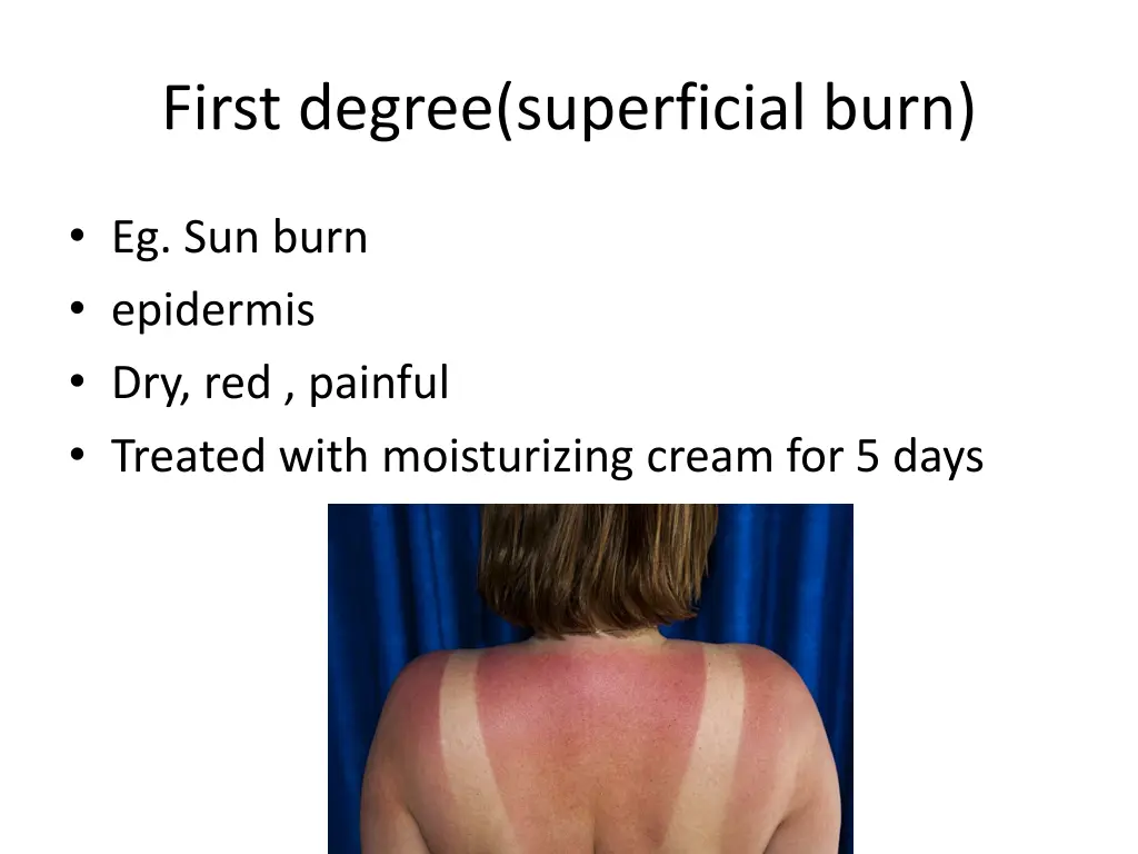 first degree superficial burn