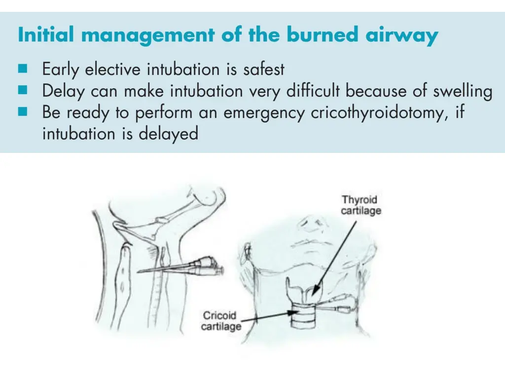 slide19