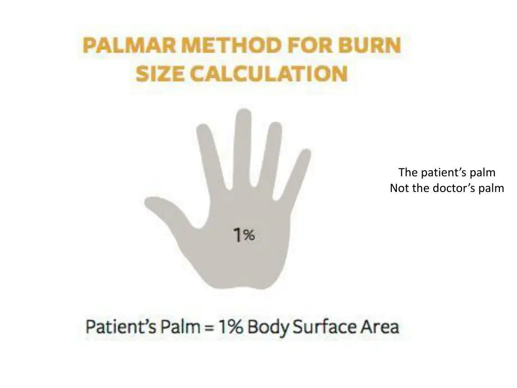 the patient s palm not the doctor s palm