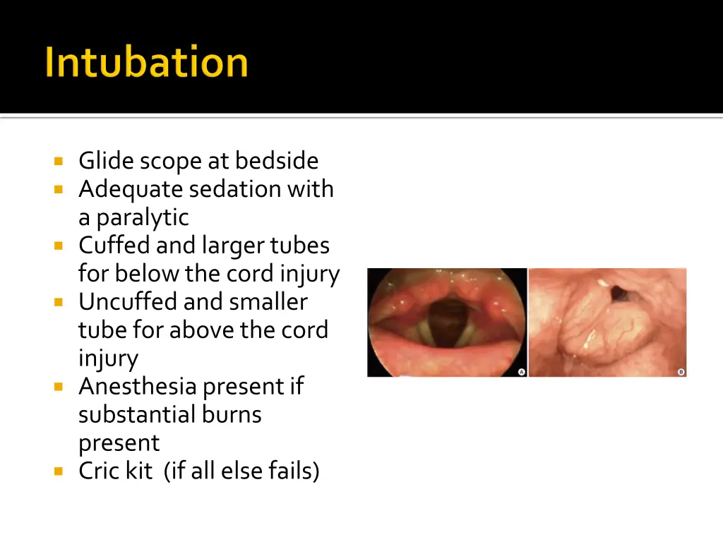 glide scope at bedside adequate sedation with