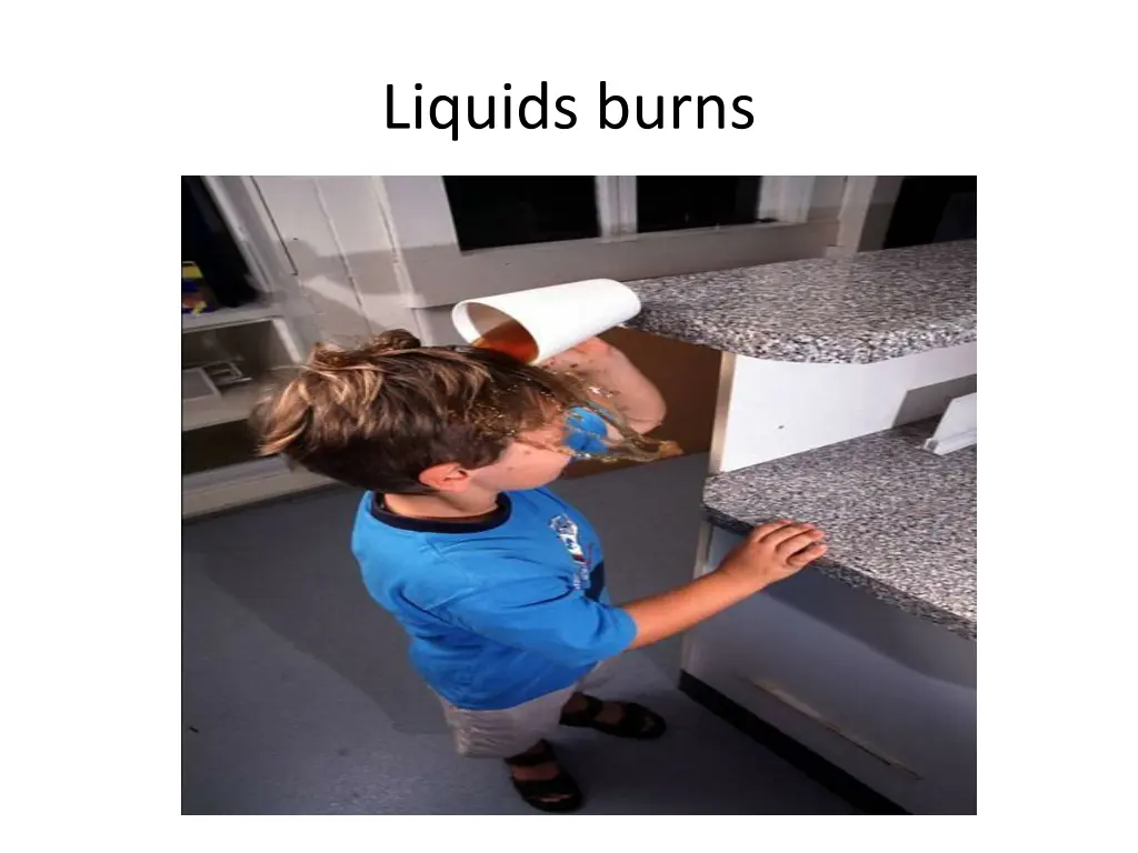 liquids burns