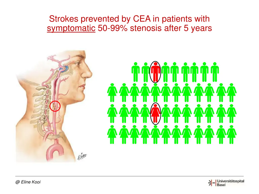 strokes prevented by cea in patients with