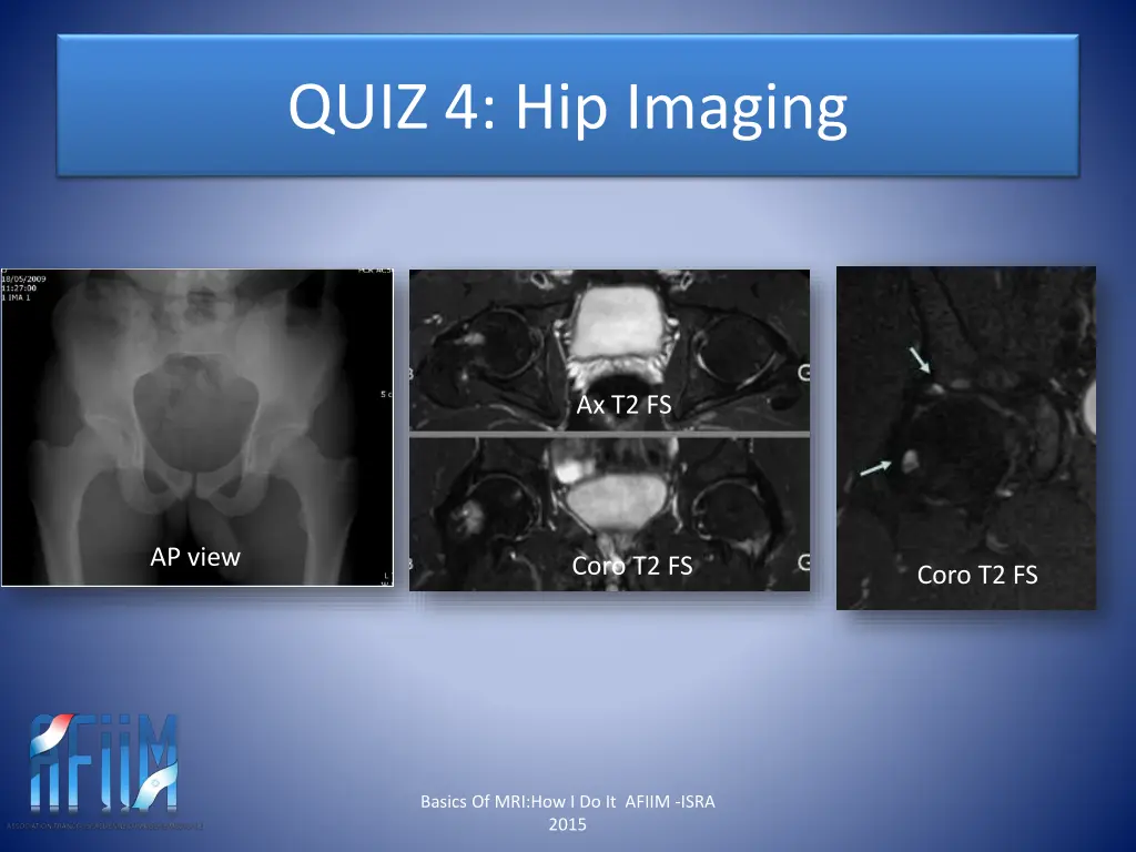 quiz 4 hip imaging 10