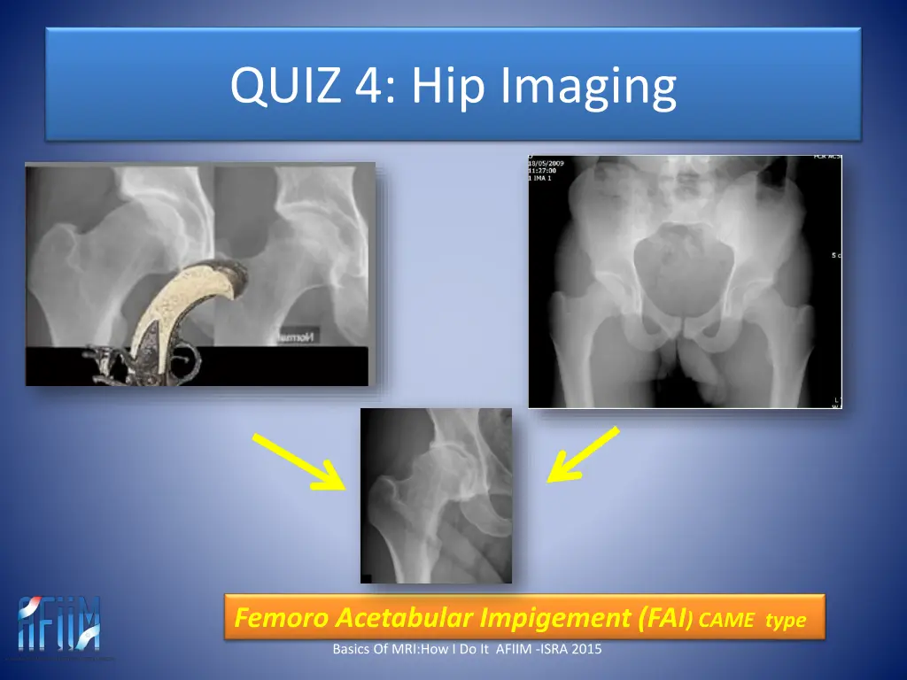 quiz 4 hip imaging 11